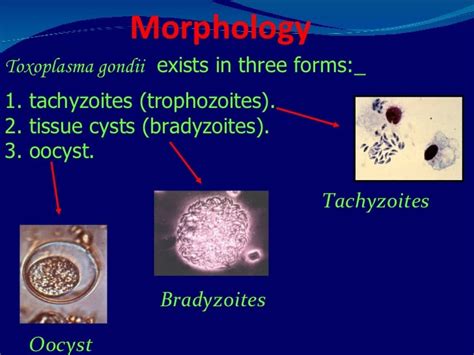 Lab 9 -toxoplasmosis