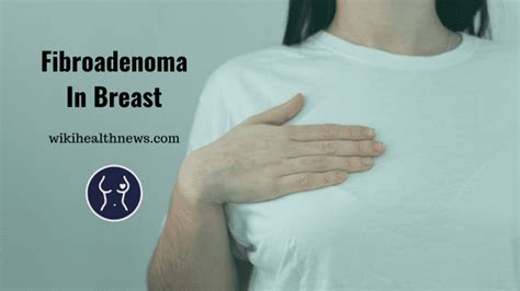 Fibroadenoma: A Solid Lump In Breast - wiki Health News