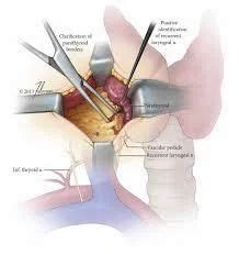 Parathyroidectomy Surgery at Rs 168000 in Nagpur | ID: 10593462288