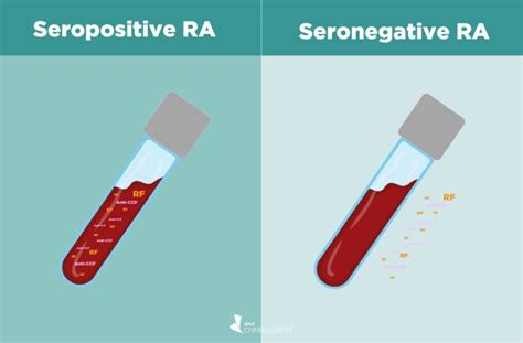 Rheumatoid Factor Is Negative: What Does It Mean?