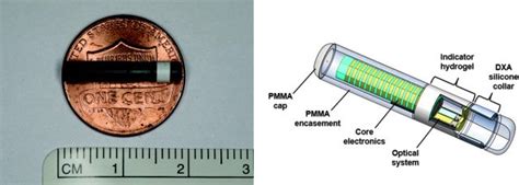 All About the Eversense XL Continuous Glucose Monitor (CGM) – Diabetes Daily