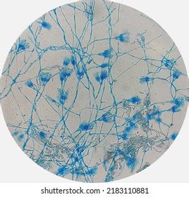 Penicillium Notatum Under Microscope