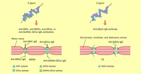 Infectious origins of, and molecular mimicry in, Guillain-Barré and Fisher syndromes - The ...