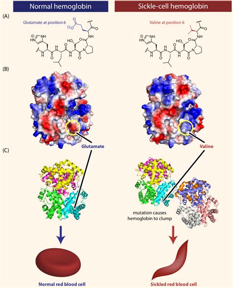 Sickle Cell Anemia Mutation