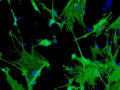 Mouse Hepatic Stellate Cells from CD1