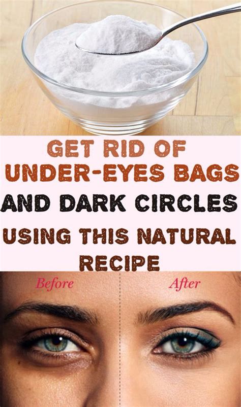 Get Rid of Under-Eyes Bags and Dark Circles Using This Natural Recipe ...