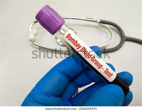 Blood Sample Bombay Blood Group Test Stock Photo 2266559471 | Shutterstock