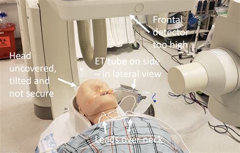 The Art of Cerebral Angiography | neuroangio.org