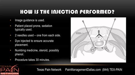 Superior Hypogastric Block info from a Dallas Pain Management Center ...