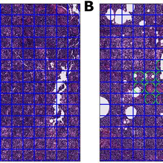 ROI and FOV examples at 20× magnification. 1A. Within this FOV, each... | Download Scientific ...