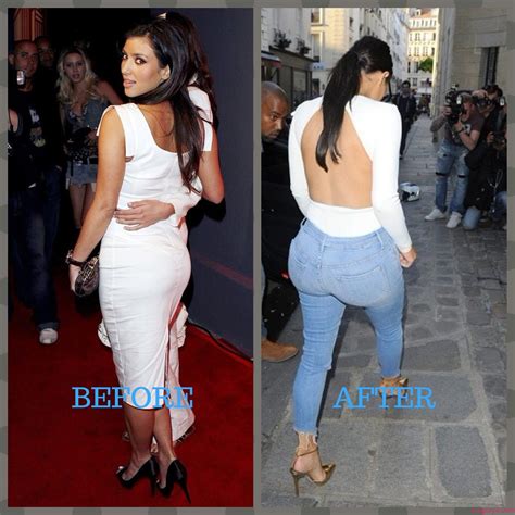 Kim Kardashian Plastic Surgery Photos [Before & After] - Surgery4