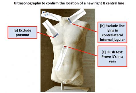 Does central line position matter? Can we use ultrasonography to ...