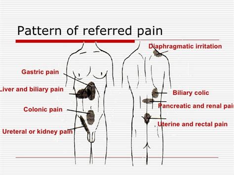 pancreatitis pain location picture Pancreatitis crónica - IMAGE FLUENT