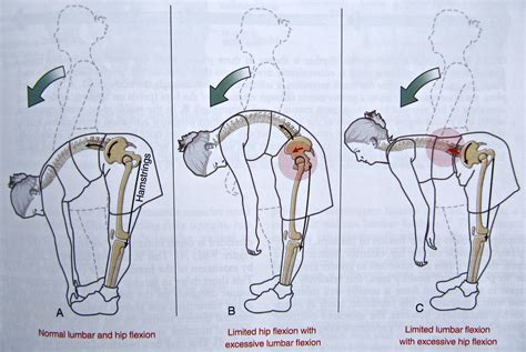 Notes on Anatomy and Physiology: Function of the Thoracolumbar Fascia ...