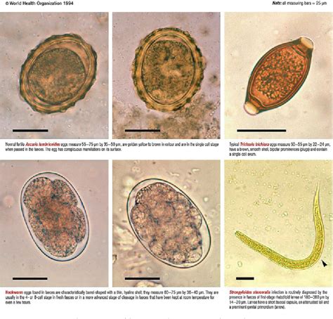 Figure 1 from A Review of the Importance of Stool Test in the Diagnosis ...