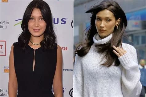 Bella Hadid's changing face: From lip fillers to facial hollowing ...