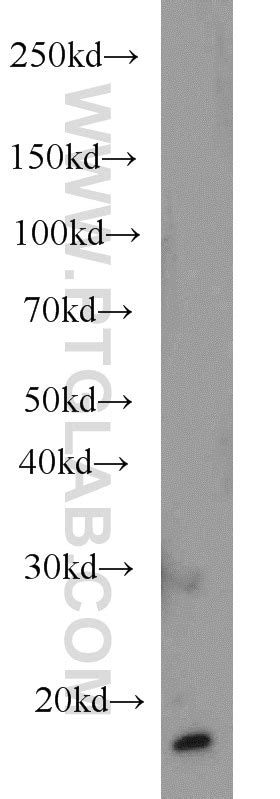 LC3 Antibody (14600-1-AP)