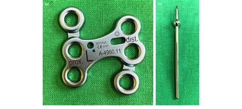 APTUS® 3.5 talonavicular fusion plate (a) and the olive pin (b). Note ...