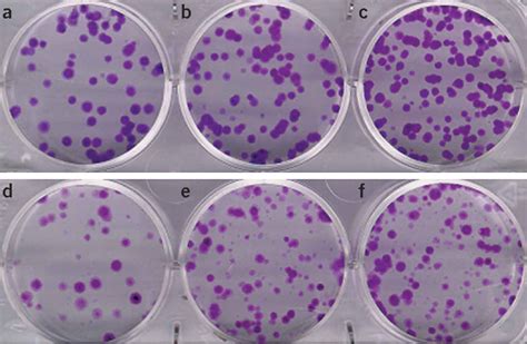 [PDF] Clonogenic assay of cells in vitro | Semantic Scholar