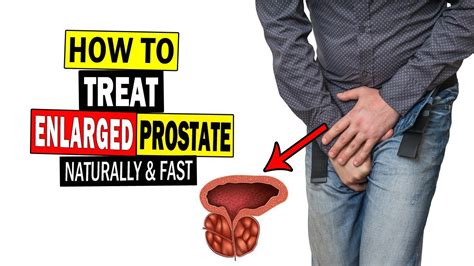 Enlarged Prostate