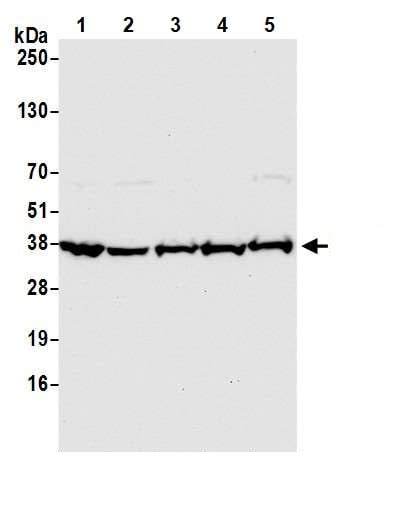 Anti-GAPDH antibody (ab245355) | Abcam