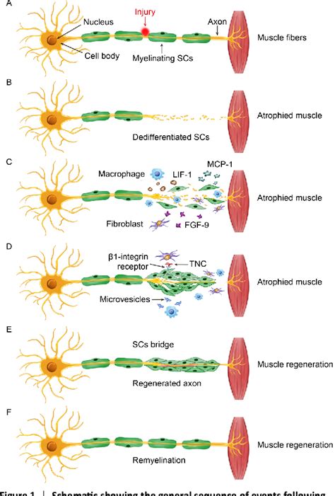 Figure 1 from Interaction between Schwann cells and other cells during repair of peripheral ...