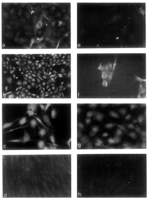 Immunofluorescence detection of von Willebrand factor antigen (vWF:Ag ...