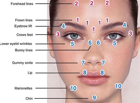 Resultado de imagem para Botox Injection Sites Chart | Eyebrow lift ...