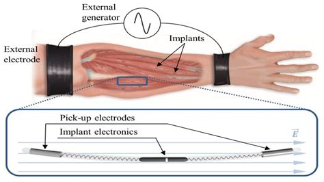 The human body as an electrical conductor, a new method of wireless power transfer