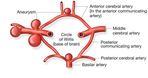 Circle of Willis - Location, Anatomy, Function and FAQs