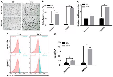 K562 cells successfully differentiated into erythroid cells under ...