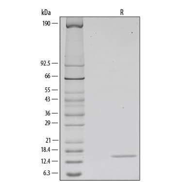 Recombinant Human GM-CSF Protein (215-GM) | Bio-Techne