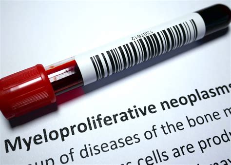 Myeloproliferative Neoplasms - Burjeel Medical City, Abu Dhabi