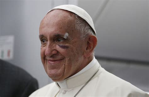 Pope Francis’ black eye tells us a lot about the church today | America ...