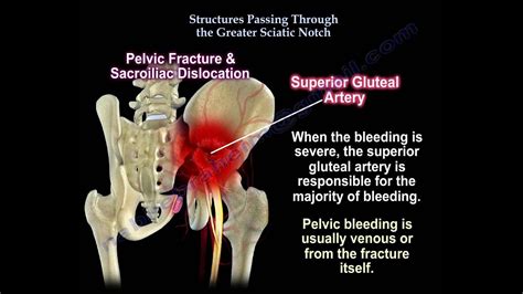 Greater And Lesser Sciatic Notch Of Hip Bone / Lumbosacral plexus & nerve distributions at ...