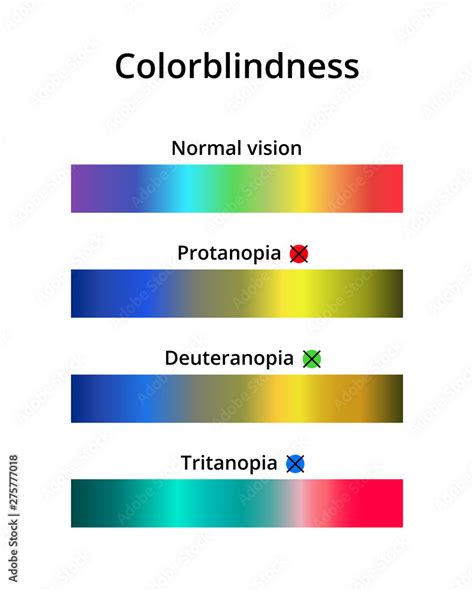 Vector illustration of color blindness or colorblindness. Normal vision ...