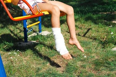 Leg Injury Stock Photos, Images and Backgrounds for Free Download