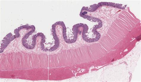 Taenia Coli Histology