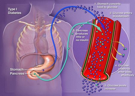 Pancreas Function In Diabetes