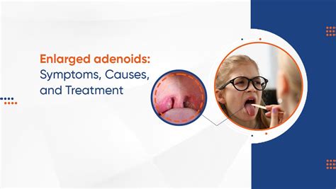 Enlarged Adenoids: Symptoms, causes, and treatment - Tambaram Medical Center