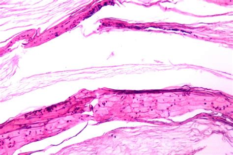 Histology of Tympanic Membrane Cast • Picture • MEDtube.net