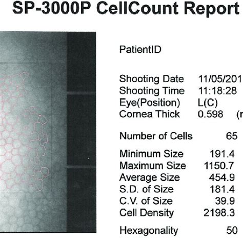 Specular microscopy report. | Download Scientific Diagram