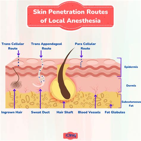 What Is Ester-Type Topical Anesthetics?