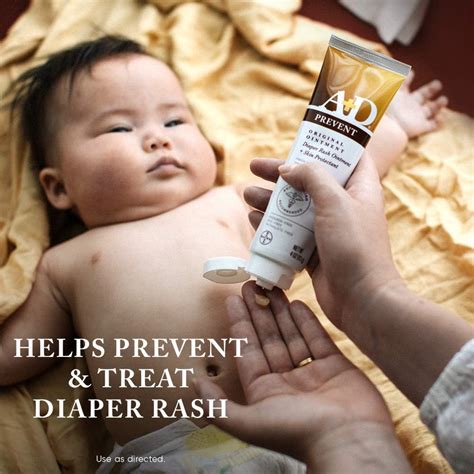 A+D Original Diaper Rash Ointment: BabiesMD-Suggests