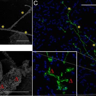 Correlative microscopy. Though imaged using different microscopic ...