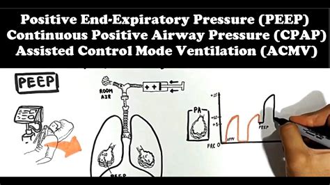 Mechanical Ventilator (Lung Mechanics: PEEP, CPAP, ACMV) - YouTube