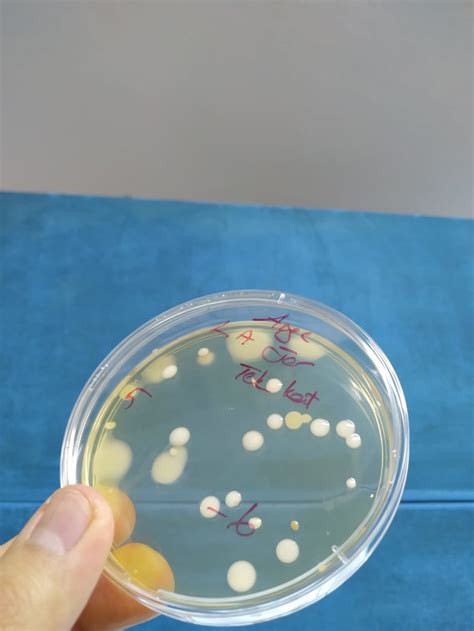 243 questions with answers in LACTIC ACID BACTERIA | Science topic