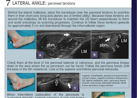 Dr.Mazhar-UL-Khaliq: Ankle Ultrasound