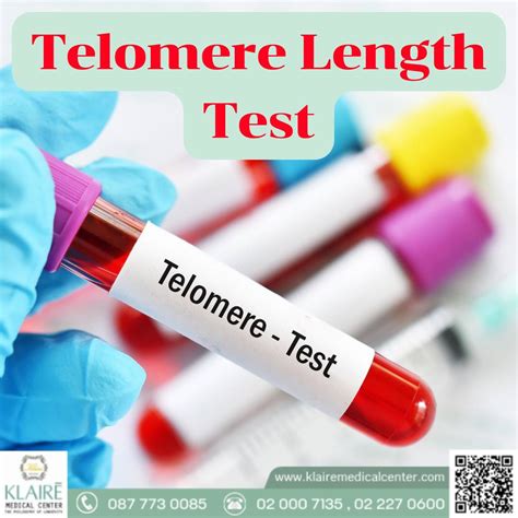 Telomere length test : Analyze life expectancy at the chromosome level - Klaire Medical Center