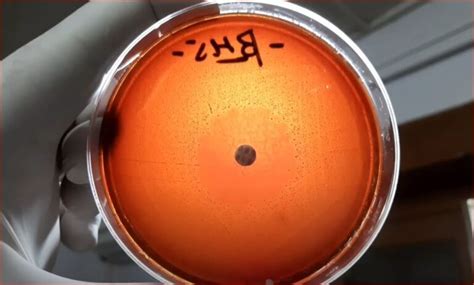 Neomycin Blood Agar: Introduction, Principle, Composition, Preparation